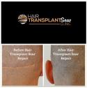 Hair Transplant Scar Clinic company logo